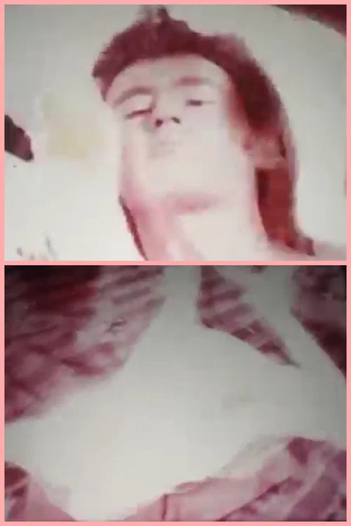 removed